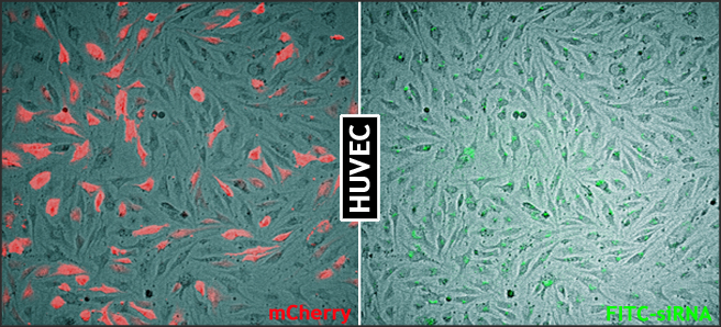 LipoJet_HUVEC_mCherry-FITC-siRNA